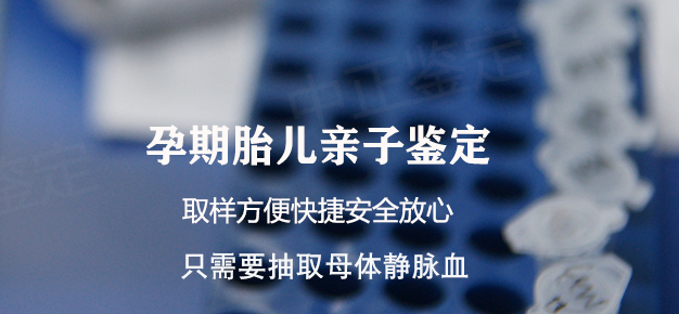 无锡孕期亲子鉴定流程是什么,无锡产前亲子鉴定中心去哪里 无锡孕期亲子鉴定流程是什么,无锡产前亲子鉴定中心去哪里