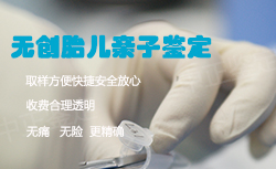 无锡孕期亲子鉴定准确性高吗[鉴定咨询]